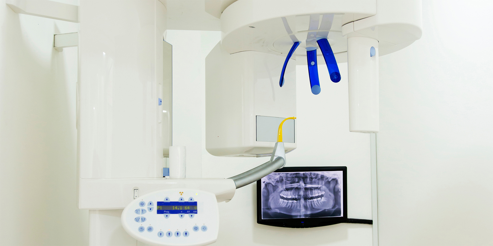 Dental Equipment Finance Loans, Leasing Dental 3D printers